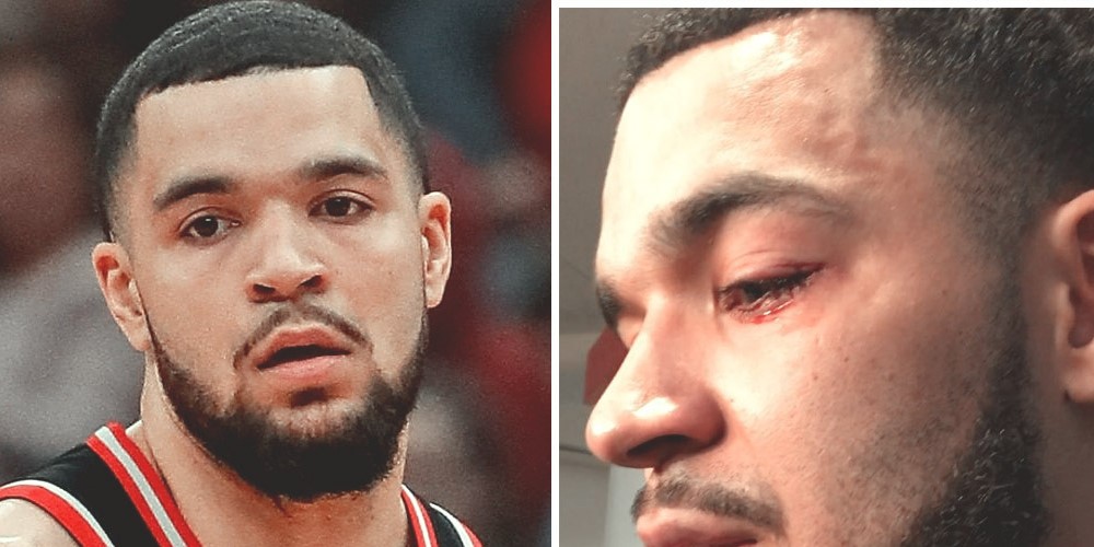 Fred VanVleet blessé à l'oeil