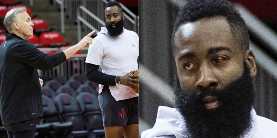 James Harden blessure oeil playoffs photos