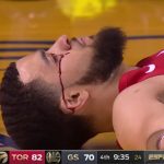 NBA – Le gros coup de coude reçu par Fred VanVleet