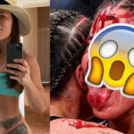 UFC 264 – Les photos choc de Jessica Eye, ouverte et ensanglantée : les fans horrifiés (-18)