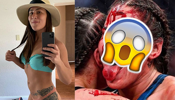 Jessica Eye révèle sa blessure horrible à l'UFC 264