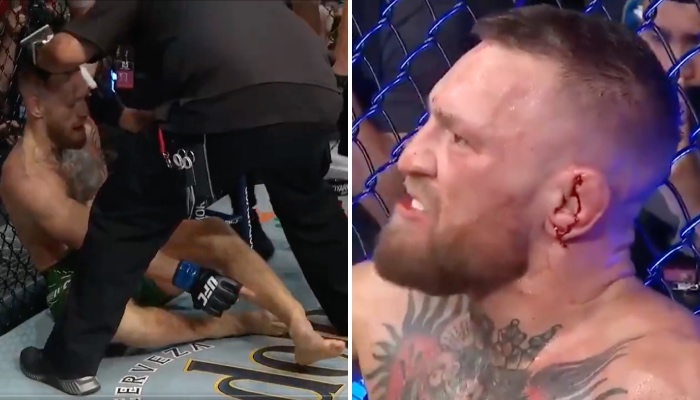 La superstar irlandaise de l'UFC, Conor McGregor, s'est sans doute fracturé la cheville durant son combat face à Dustin Poirier, ce qui ne l'a pas empêché de trash-talker son adversaire... sur sa femme
