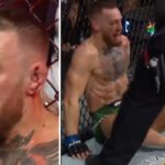 UFC – Au sol et le tibia brisé, la séquence de Conor McGregor qui choque les Américains !