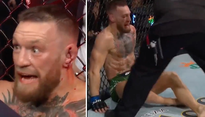 Le combattant UFC irlandais, Conor McGregor, a choqué les fans dans les secondes qui ont suivi sa blessure synonyme de défaite face à Dustin Poirier