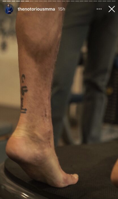 Le tibia de Conor McGregor après sa blessure (zoom)