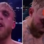 Fight – L’impressionnante blessure de Jake Paul en plein combat ! (vidéo)