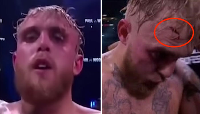 L'impressionnante blessure de Jake Paul en plein combat ! (vidéo)