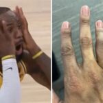 NBA – Le doigt flippant d’une star de la ligue !