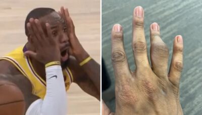 NBA – Le doigt flippant d’une star de la ligue !