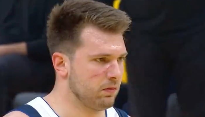 NBA Luka Doncic salement égratigné dans le Game 1