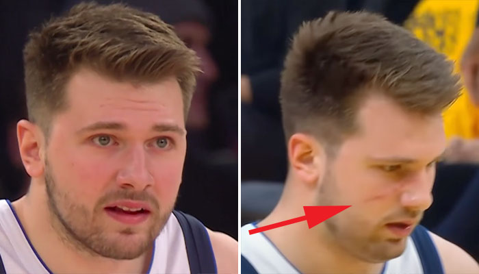 La réponse virale de Luka Doncic après son vilain coup reçu !