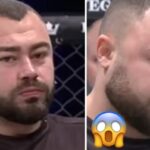 UFC – Scène dingue en Slap Fighting Championship, le champion termine défiguré ! (vidéo)